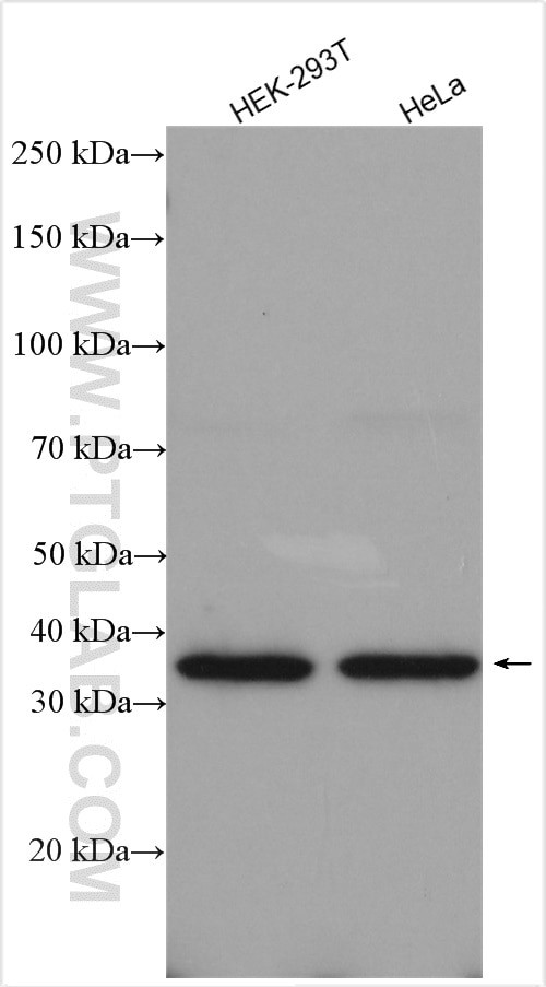 NAGK Antibody in Western Blot (WB)