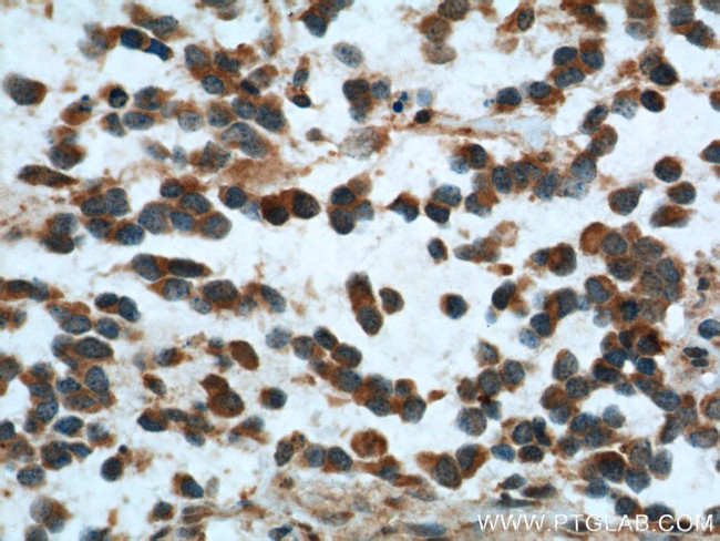 SMOX Antibody in Immunohistochemistry (Paraffin) (IHC (P))