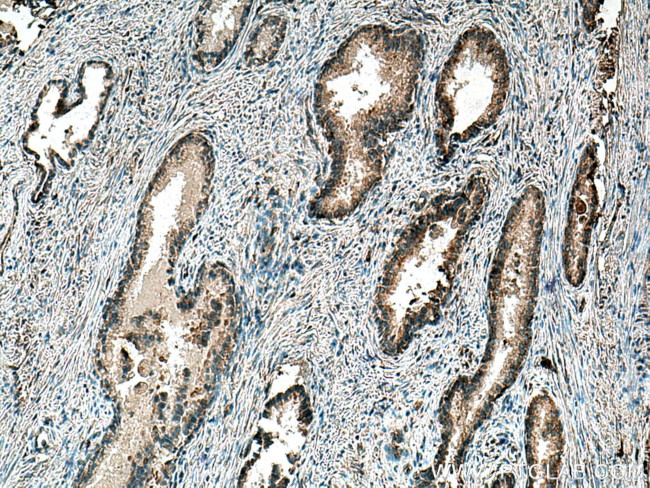 SMOX Antibody in Immunohistochemistry (Paraffin) (IHC (P))