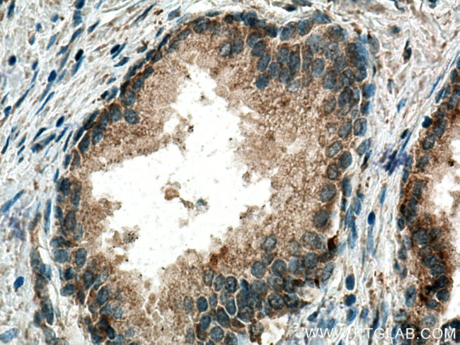 SMOX Antibody in Immunohistochemistry (Paraffin) (IHC (P))