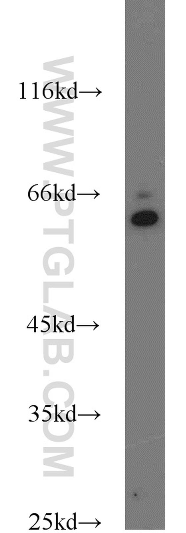 SMOX Antibody in Western Blot (WB)