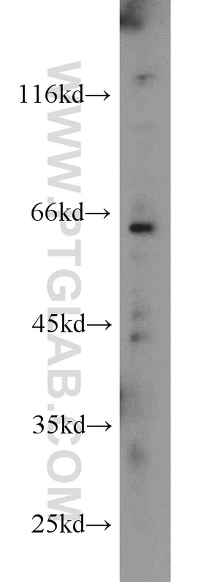 SMOX Antibody in Western Blot (WB)