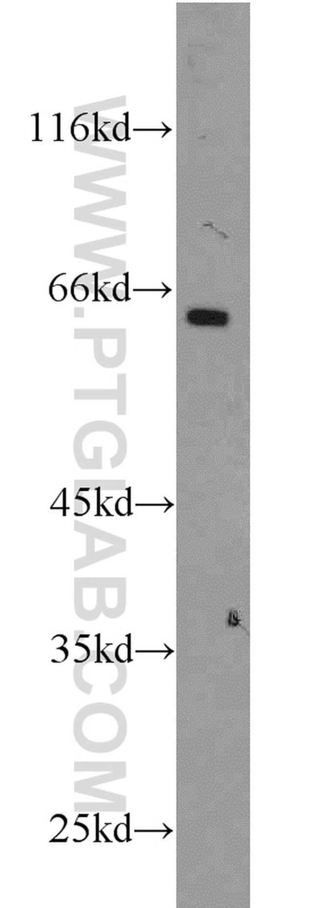 SMOX Antibody in Western Blot (WB)