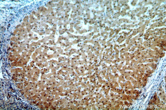 TRNAU1AP/SECP43 Antibody in Immunohistochemistry (Paraffin) (IHC (P))