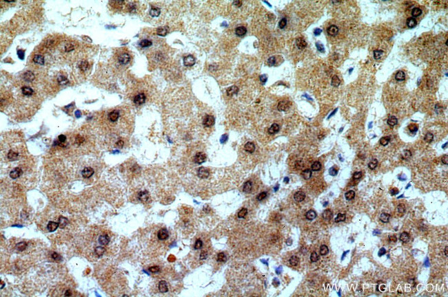 TRNAU1AP/SECP43 Antibody in Immunohistochemistry (Paraffin) (IHC (P))