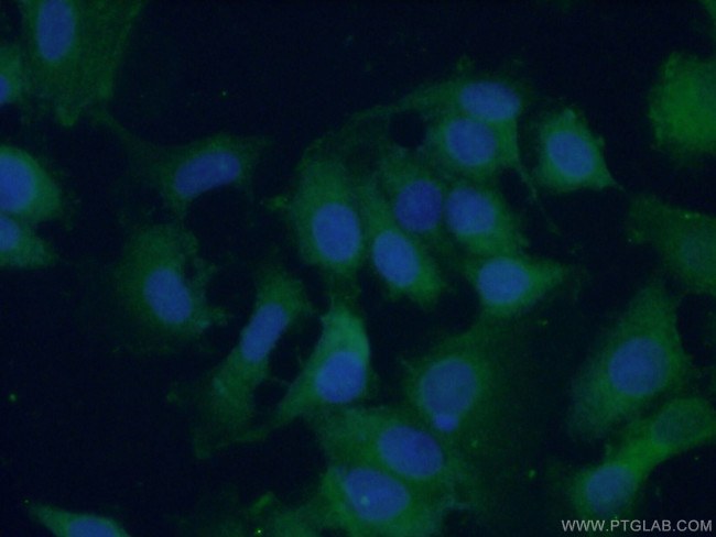 RPL38 Antibody in Immunocytochemistry (ICC/IF)