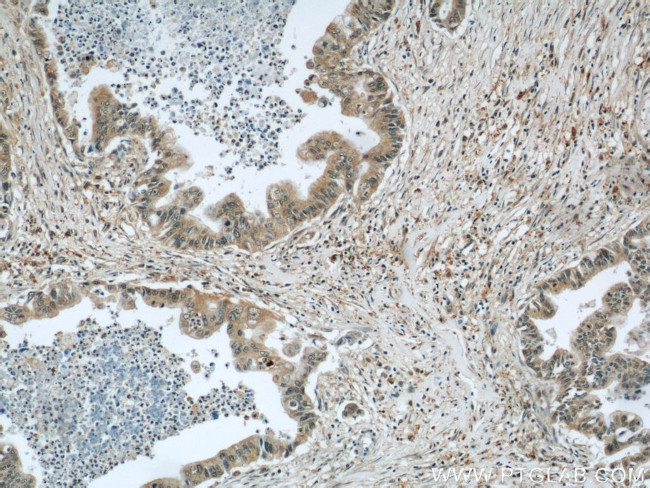 RPL38 Antibody in Immunohistochemistry (Paraffin) (IHC (P))