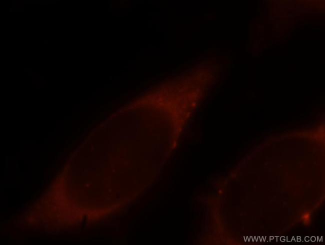 ARPC2 Antibody in Immunocytochemistry (ICC/IF)