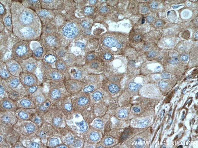 ARPC2 Antibody in Immunohistochemistry (Paraffin) (IHC (P))