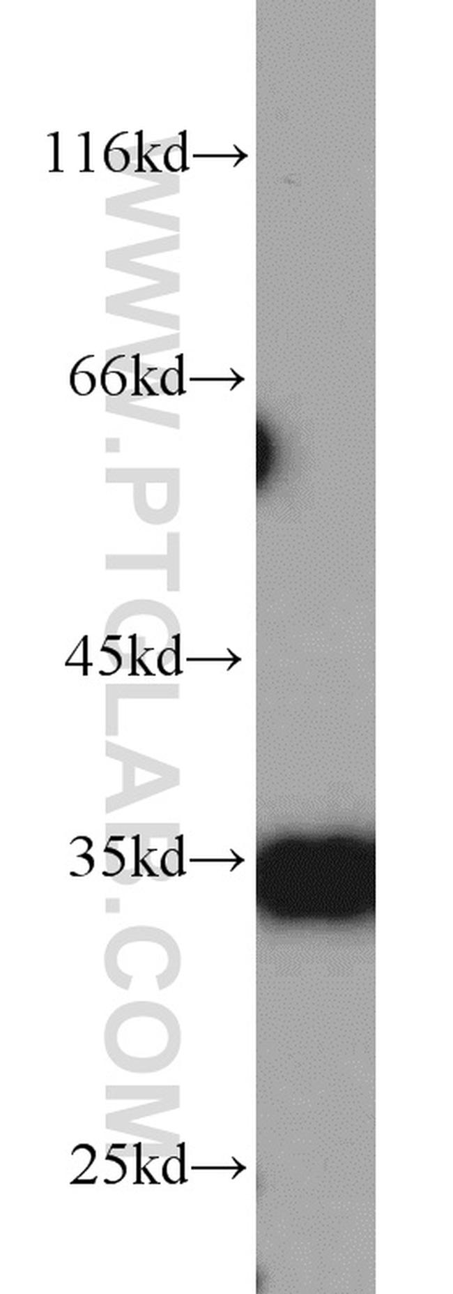 ARPC2 Antibody in Western Blot (WB)