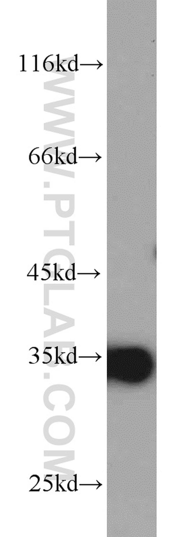 ARPC2 Antibody in Western Blot (WB)