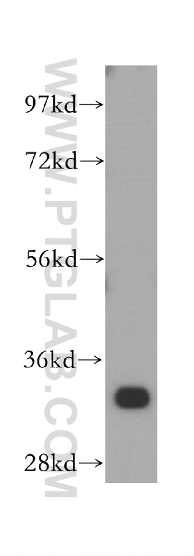 ARPC2 Antibody in Western Blot (WB)