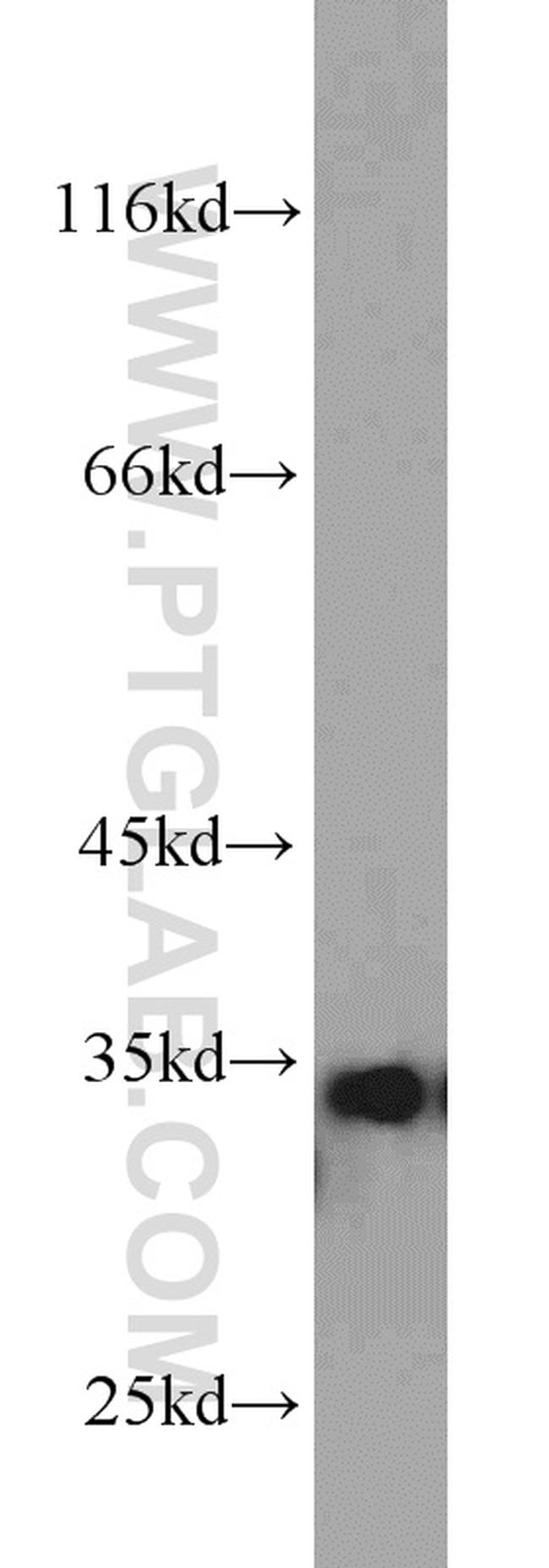 ARPC2 Antibody in Western Blot (WB)