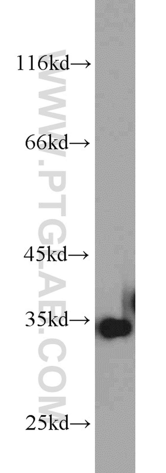 ARPC2 Antibody in Western Blot (WB)