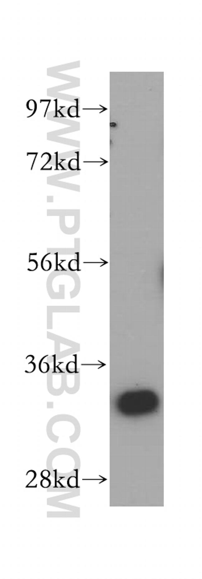 ARPC2 Antibody in Western Blot (WB)