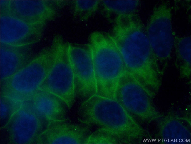 HPRT1 Antibody in Immunocytochemistry (ICC/IF)