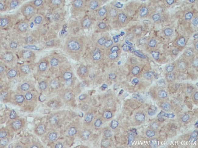 HPRT1 Antibody in Immunohistochemistry (Paraffin) (IHC (P))