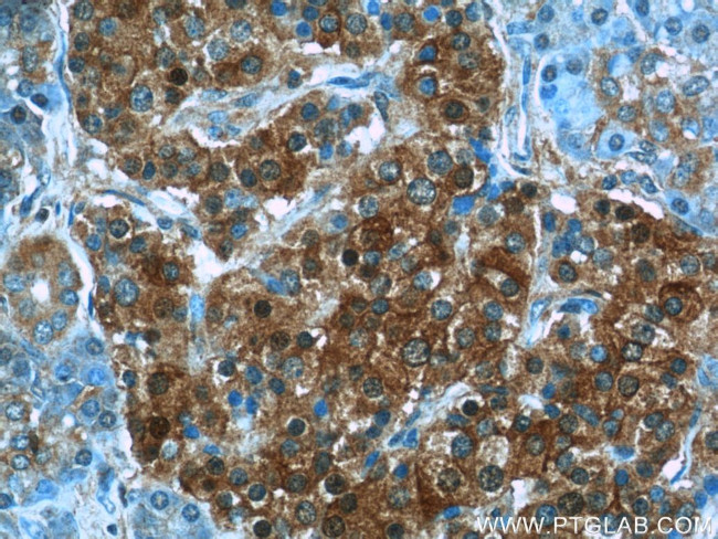 HPRT1 Antibody in Immunohistochemistry (Paraffin) (IHC (P))