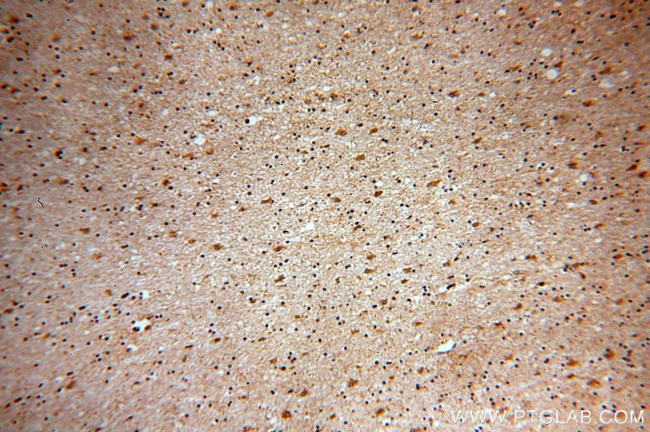 HPRT1 Antibody in Immunohistochemistry (Paraffin) (IHC (P))