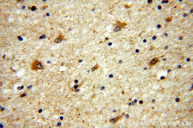 HPRT1 Antibody in Immunohistochemistry (Paraffin) (IHC (P))