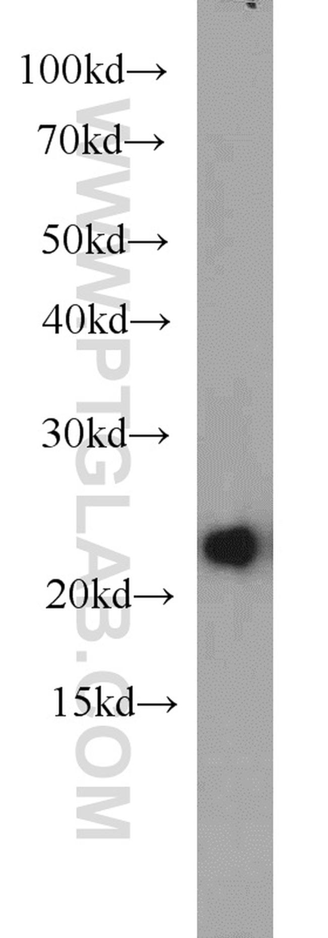 HPRT1 Antibody in Western Blot (WB)