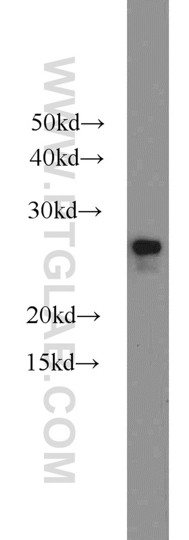 HPRT1 Antibody in Western Blot (WB)