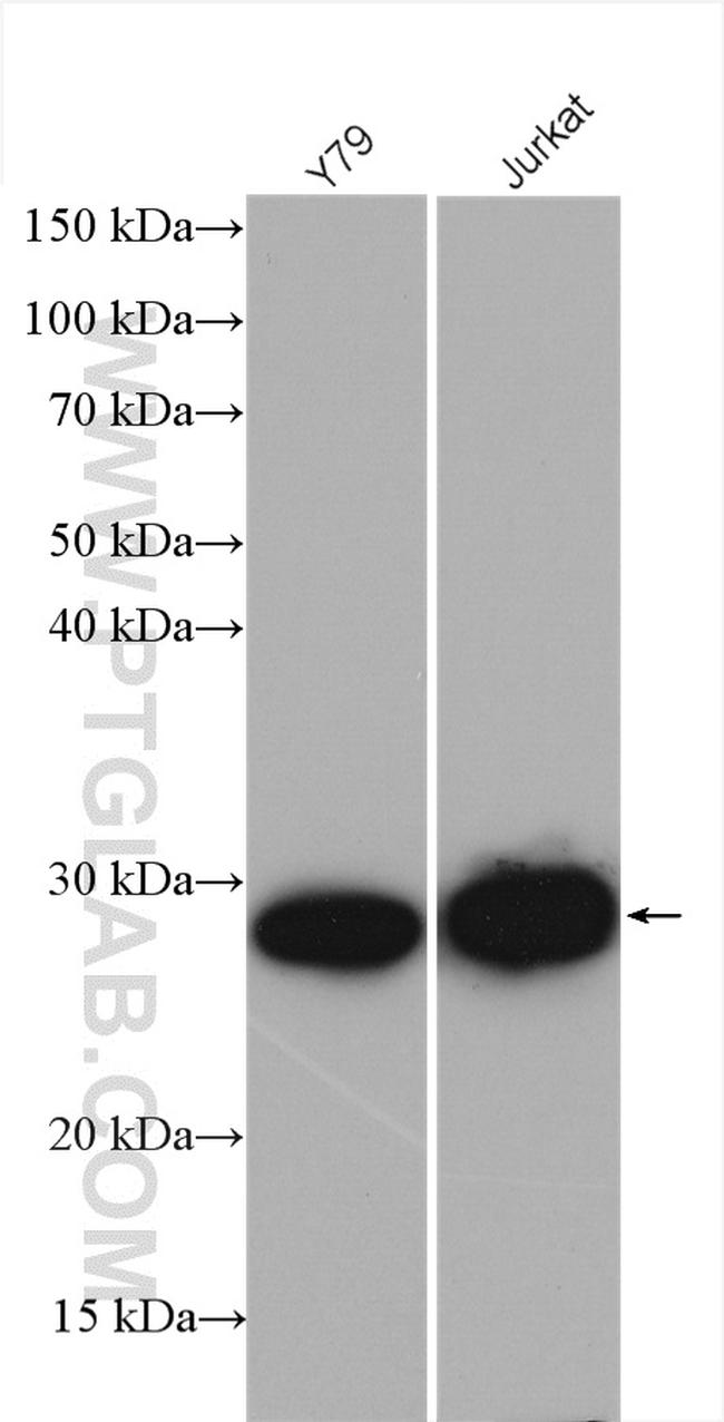 HPRT1 Antibody in Western Blot (WB)