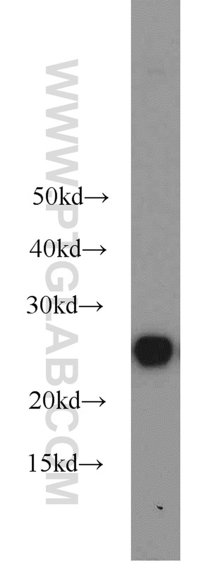 HPRT1 Antibody in Western Blot (WB)