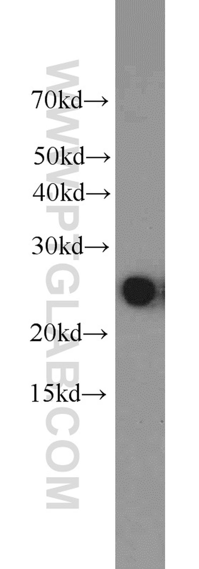 HPRT1 Antibody in Western Blot (WB)