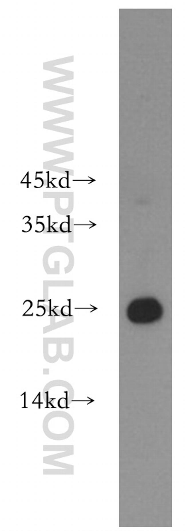 HPRT1 Antibody in Western Blot (WB)