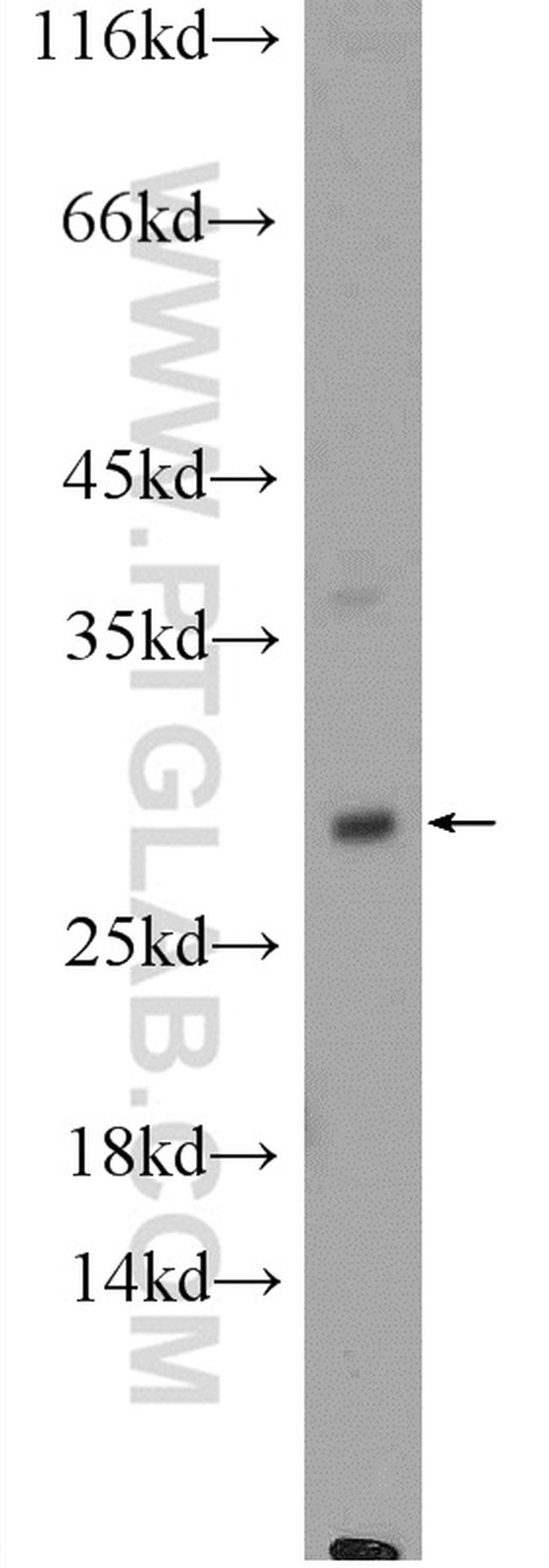 HPRT1 Antibody in Western Blot (WB)