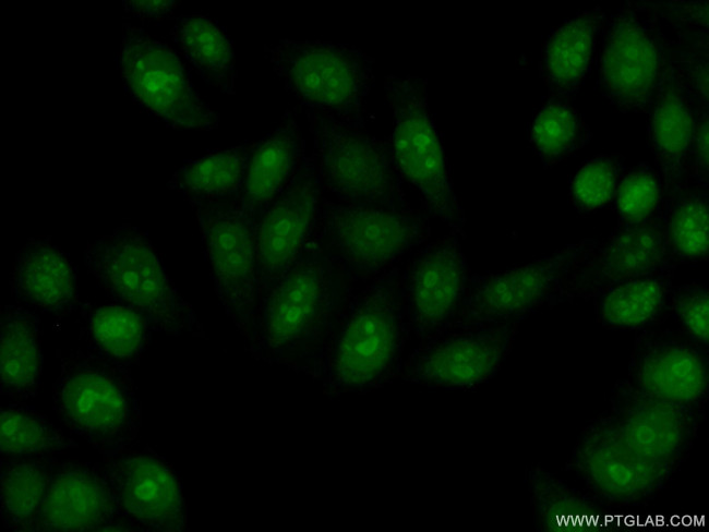 EXOSC3 Antibody in Immunocytochemistry (ICC/IF)