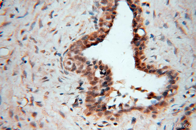 EXOSC3 Antibody in Immunohistochemistry (Paraffin) (IHC (P))