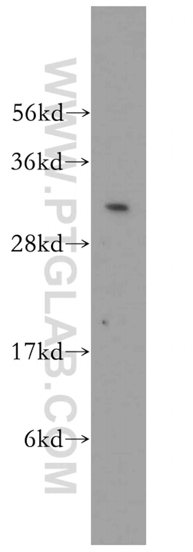 EXOSC3 Antibody in Western Blot (WB)