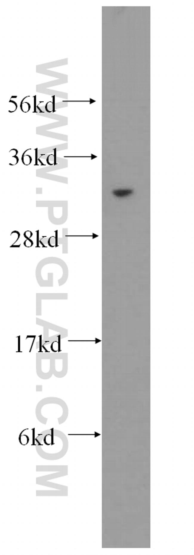 EXOSC3 Antibody in Western Blot (WB)