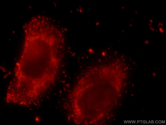 NDUFS3 Antibody in Immunocytochemistry (ICC/IF)