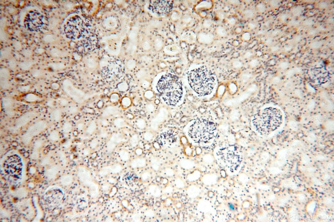 NDUFS3 Antibody in Immunohistochemistry (Paraffin) (IHC (P))