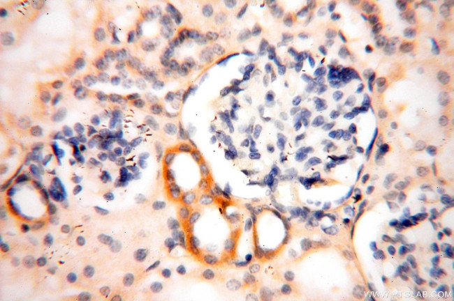 NDUFS3 Antibody in Immunohistochemistry (Paraffin) (IHC (P))