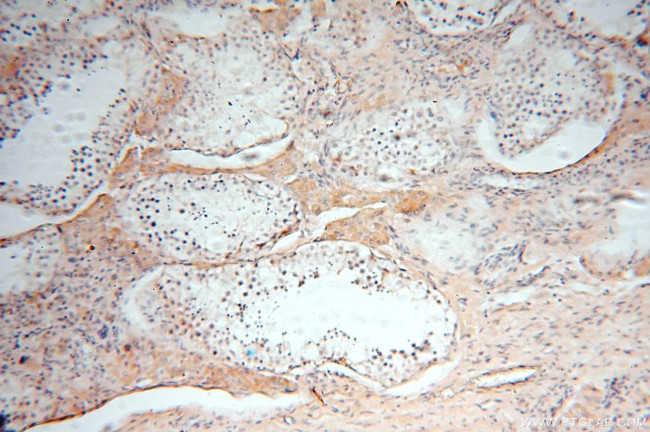 NDUFS3 Antibody in Immunohistochemistry (Paraffin) (IHC (P))