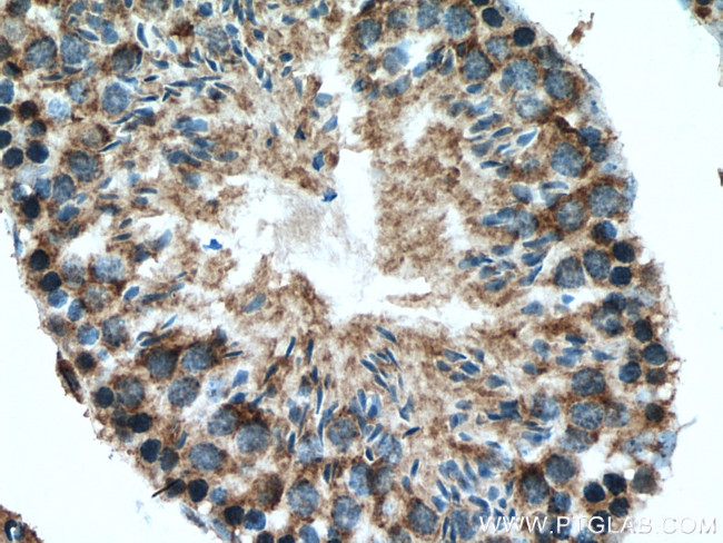 NDUFS3 Antibody in Immunohistochemistry (Paraffin) (IHC (P))