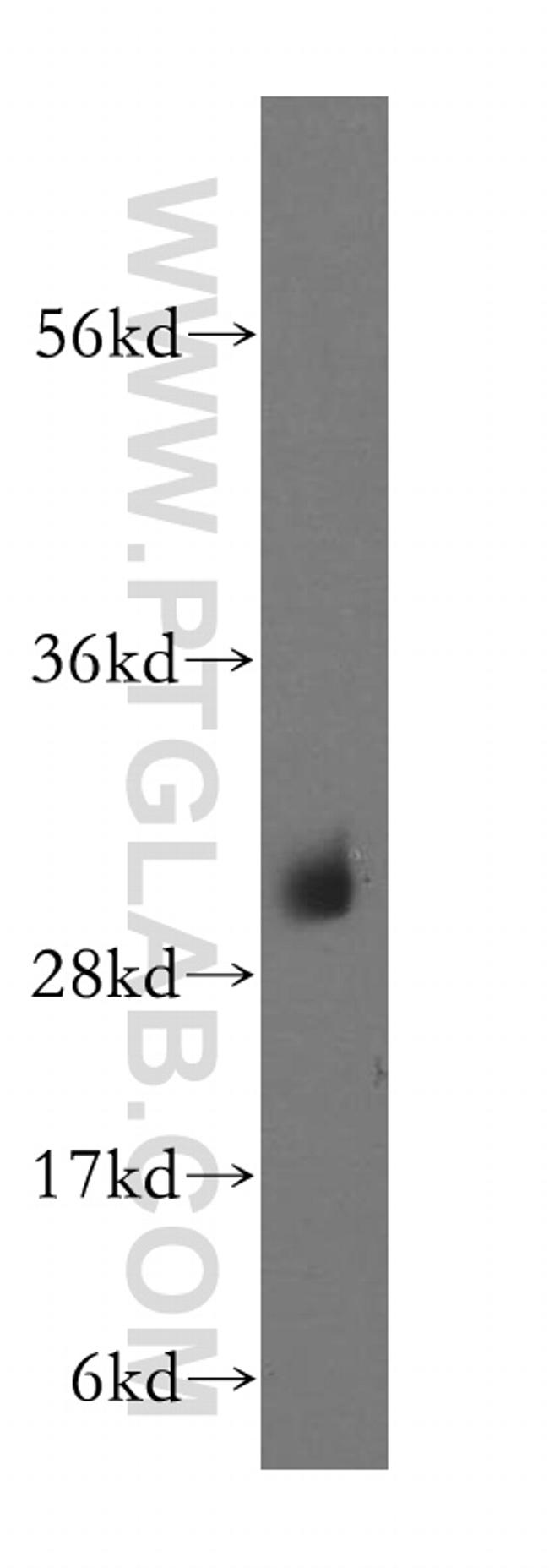 NDUFS3 Antibody in Western Blot (WB)