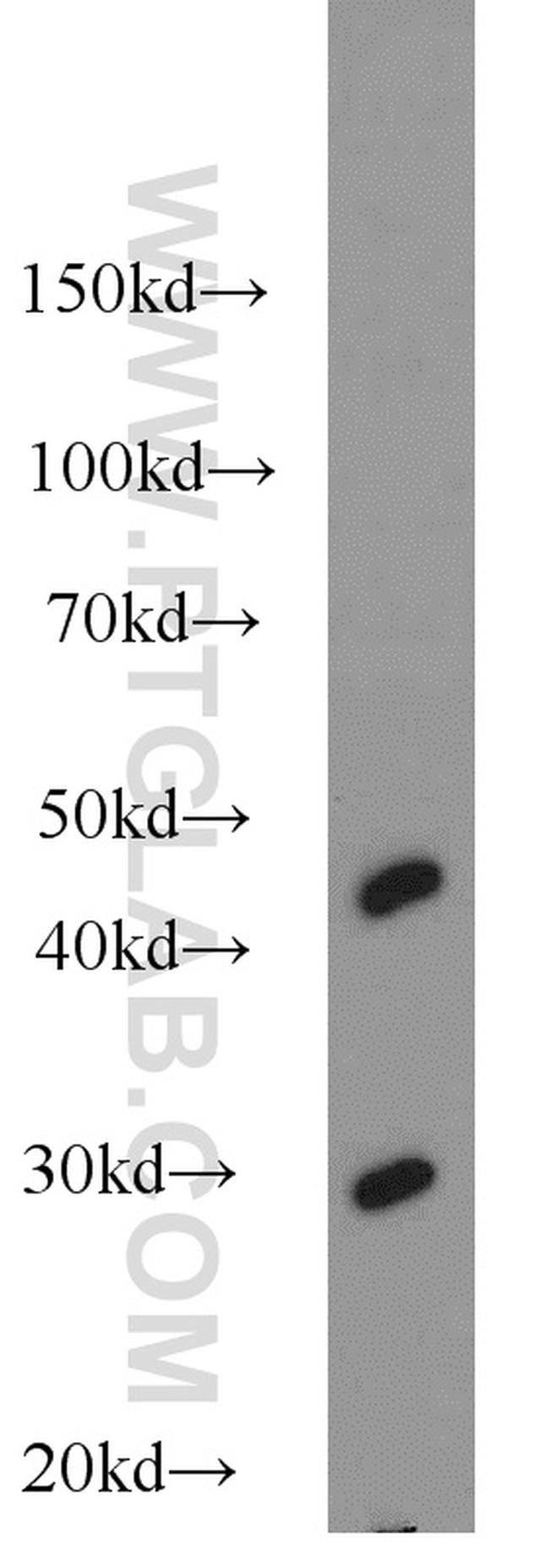 NDUFS3 Antibody in Western Blot (WB)