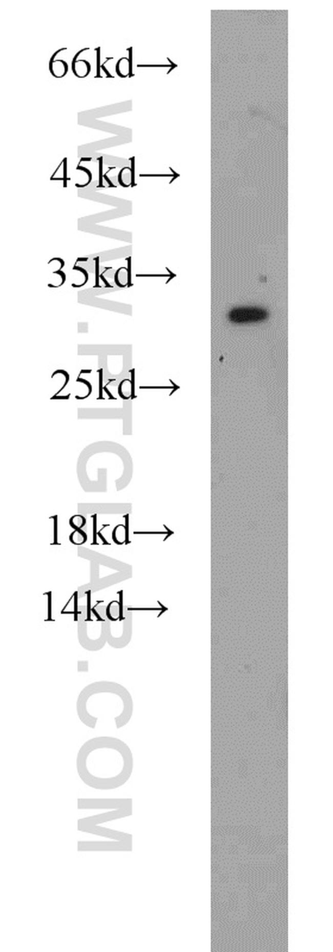 NDUFS3 Antibody in Western Blot (WB)