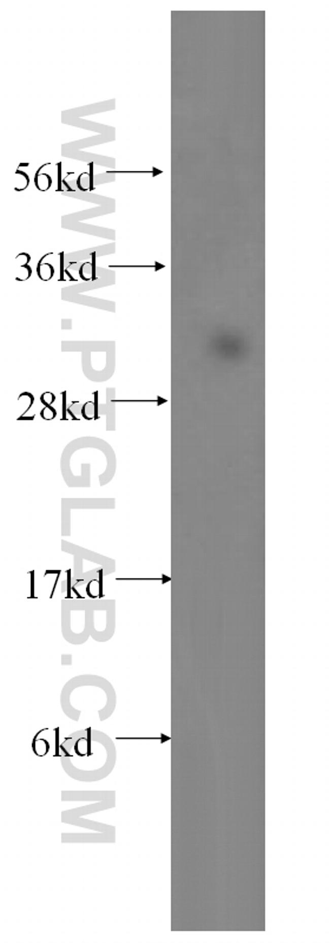 NDUFS3 Antibody in Western Blot (WB)