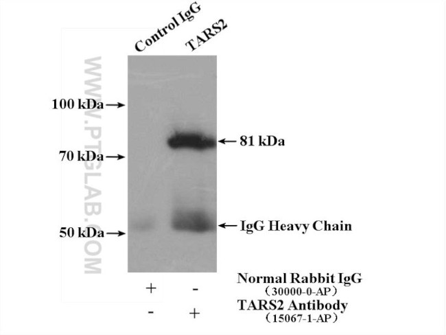 TARS2 Antibody in Immunoprecipitation (IP)