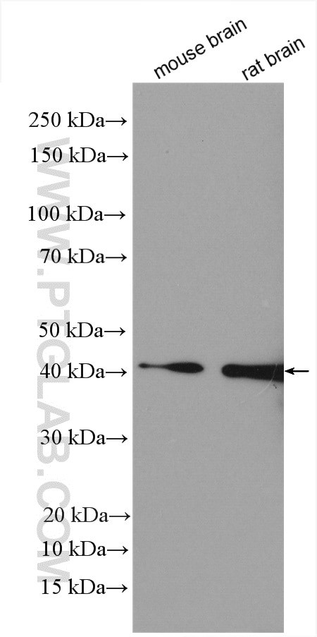 NUDT9 Antibody in Western Blot (WB)