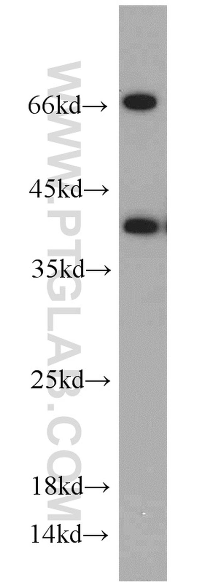 NUDT9 Antibody in Western Blot (WB)