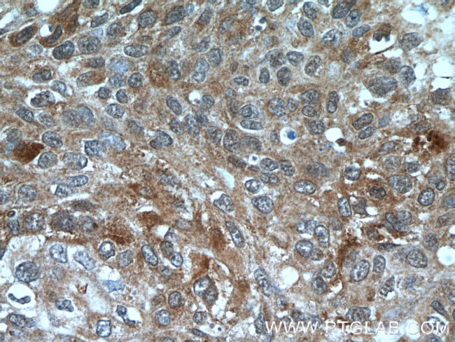 PCBP2 Antibody in Immunohistochemistry (Paraffin) (IHC (P))