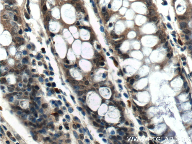 PCBP2 Antibody in Immunohistochemistry (Paraffin) (IHC (P))