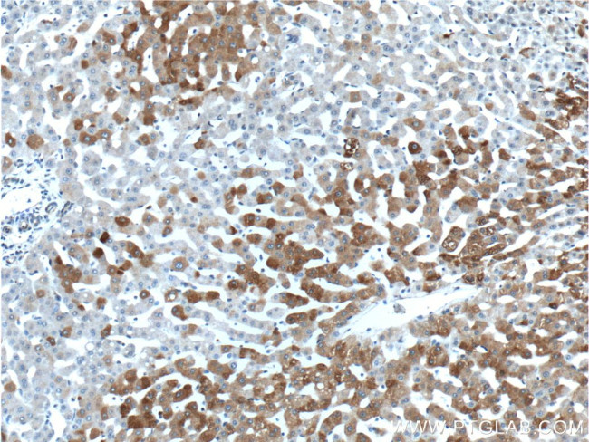 PCBP2 Antibody in Immunohistochemistry (Paraffin) (IHC (P))